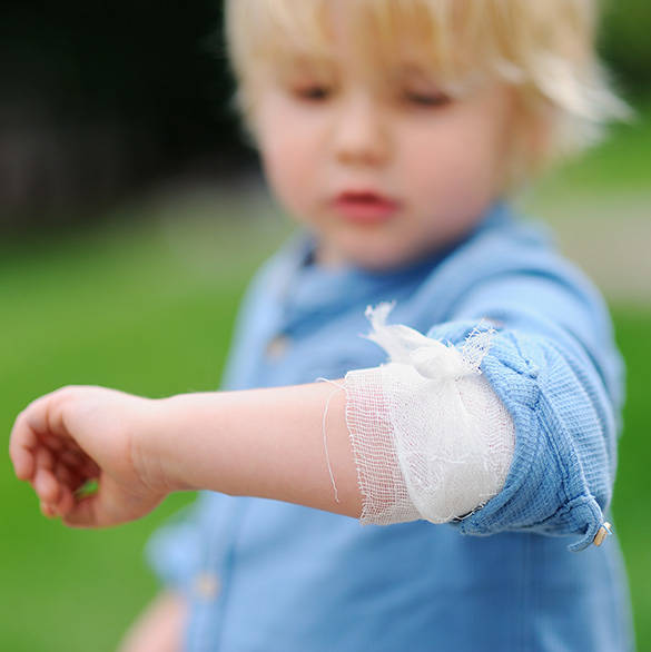 Gutt med bandasje på armen