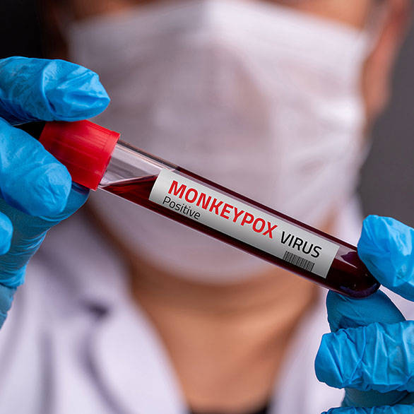 M-pox