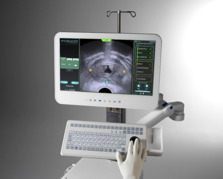 Aquabeam Robotic System | Mediq
